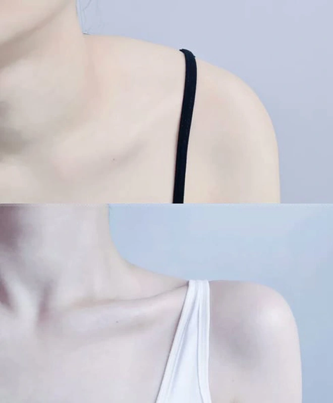 Bờ vai "móc áo" hoàn toàn có thể có được do tập luyện. Ảnh: Weibo