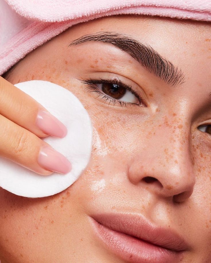 Một lớp toner hoặc lotion sẽ là "liều thuốc" xoa dịu hiệu quả. Ảnh: internet.